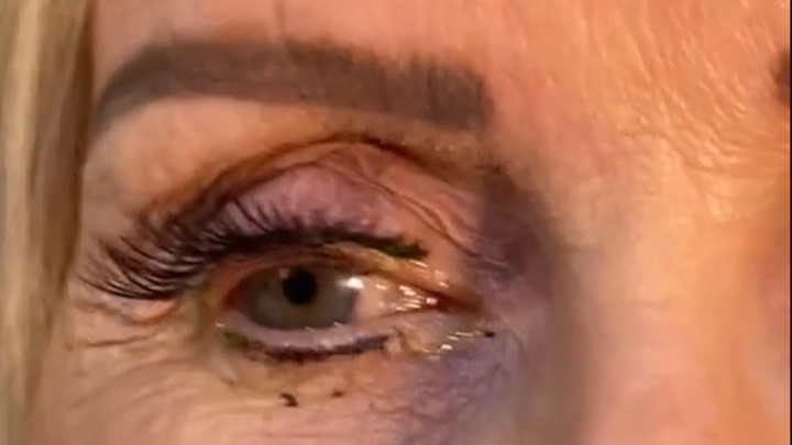 病人因眼部不适库尔蒂瓦的诊所求医。网上影片截图