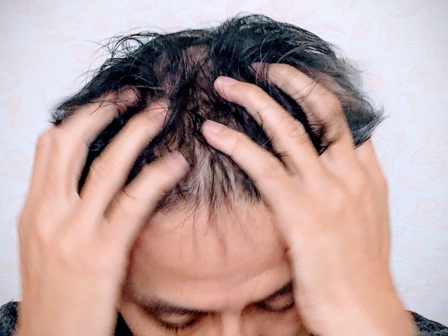 中醫解構男士脫髮成因 原來因房事無節制致腎精不足！（示意圖/圖片來源：PhotoAC）