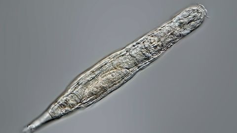 西伯利亚冰封24000年蛭形轮虫重获生命。 网上图片