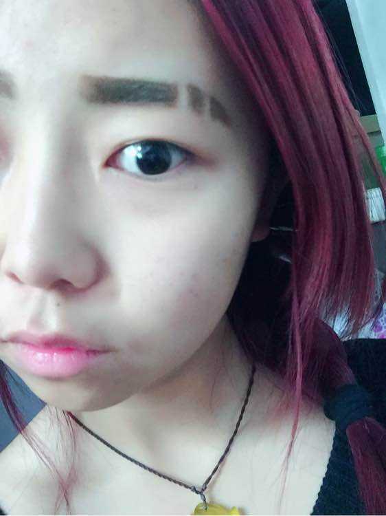 有如眉部有疤痕一樣。