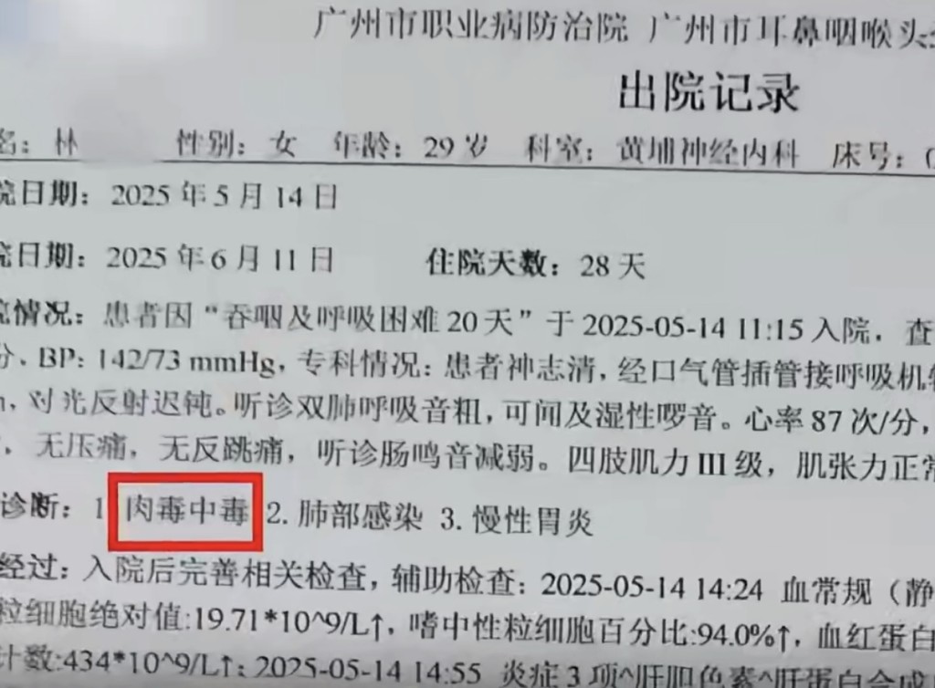 廣東29歲女打瘦臉針中毒入ICU。大象新聞 廣東29歲女打瘦臉針中毒入ICU。大象新聞