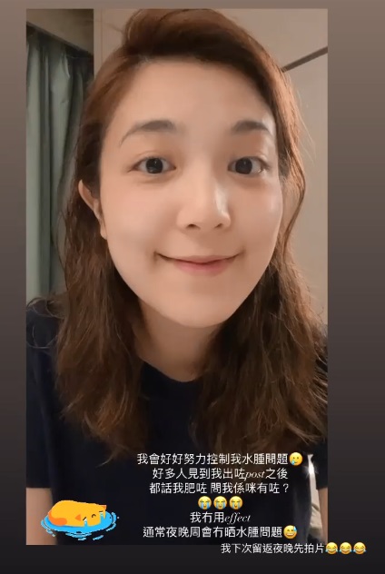 她指自己只是水腫。