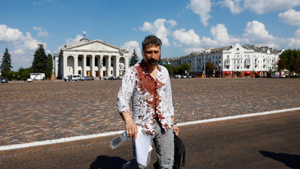 一名受傷男子滿身是血離開切爾尼戈夫劇院。 路透社