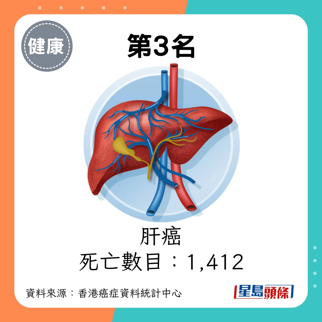 第3名：肝癌（死亡數目：1,412）