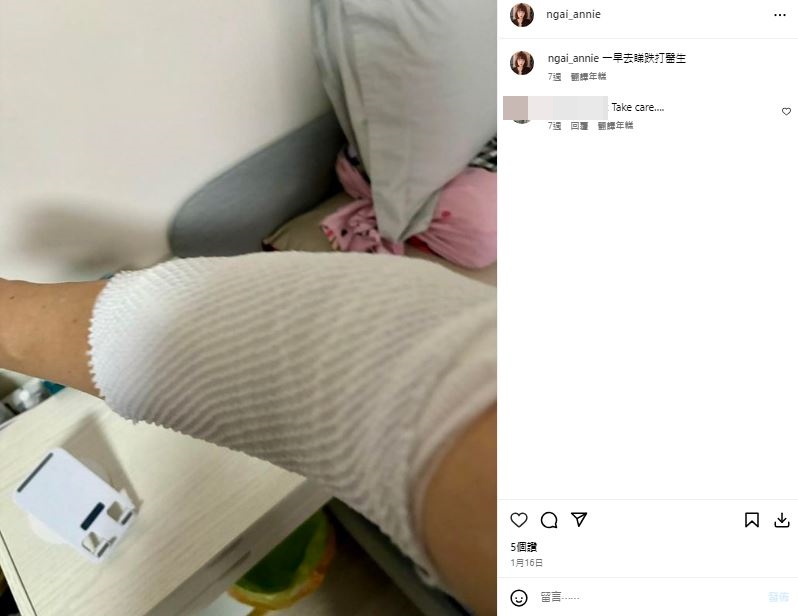 倪詩蓓今年1月中於IG貼出手臂包紮照。