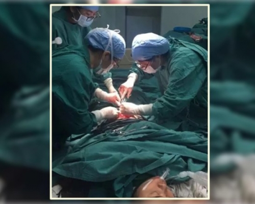 為免胎死腹中,李婦決定接受醫生建議,在沒有麻醉的情況下剖腹取出嬰兒。 網上圖片