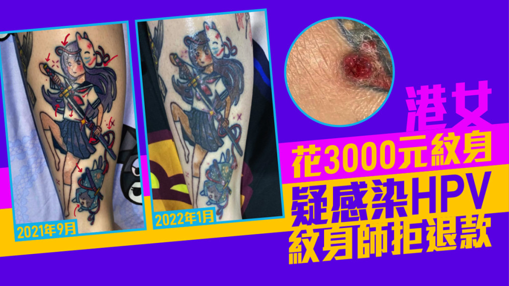 港女花3000元紋身疑感染HPV 紋身師拒退款