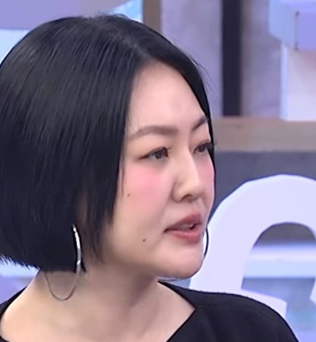 近日有眼利網民發現小S臉上多了兩顆痣，瞬間成為網絡焦點。