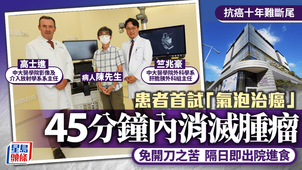 氣泡治癌︱抗癌十年患者首試免開刀之苦 45分鐘內消滅腫瘤