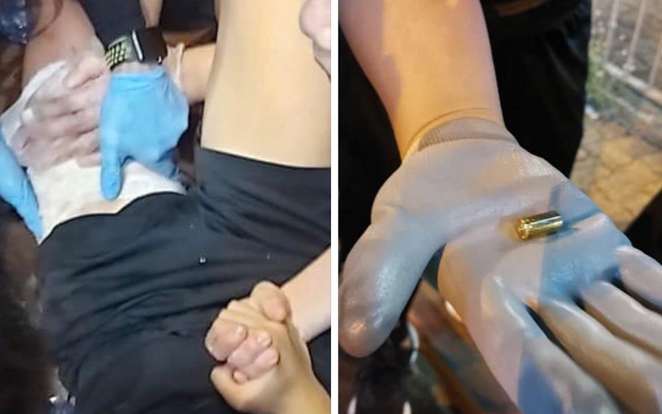 元朗有示威者中槍。張秀賢facebook圖片