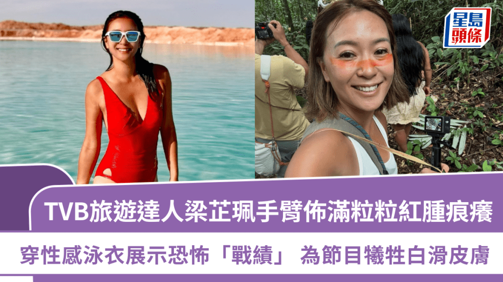 TVB旅遊達人梁芷珮手臂佈滿粒粒紅腫痕癢  穿性感泳衣展示恐怖「戰績」  為節目犧牲白滑皮膚