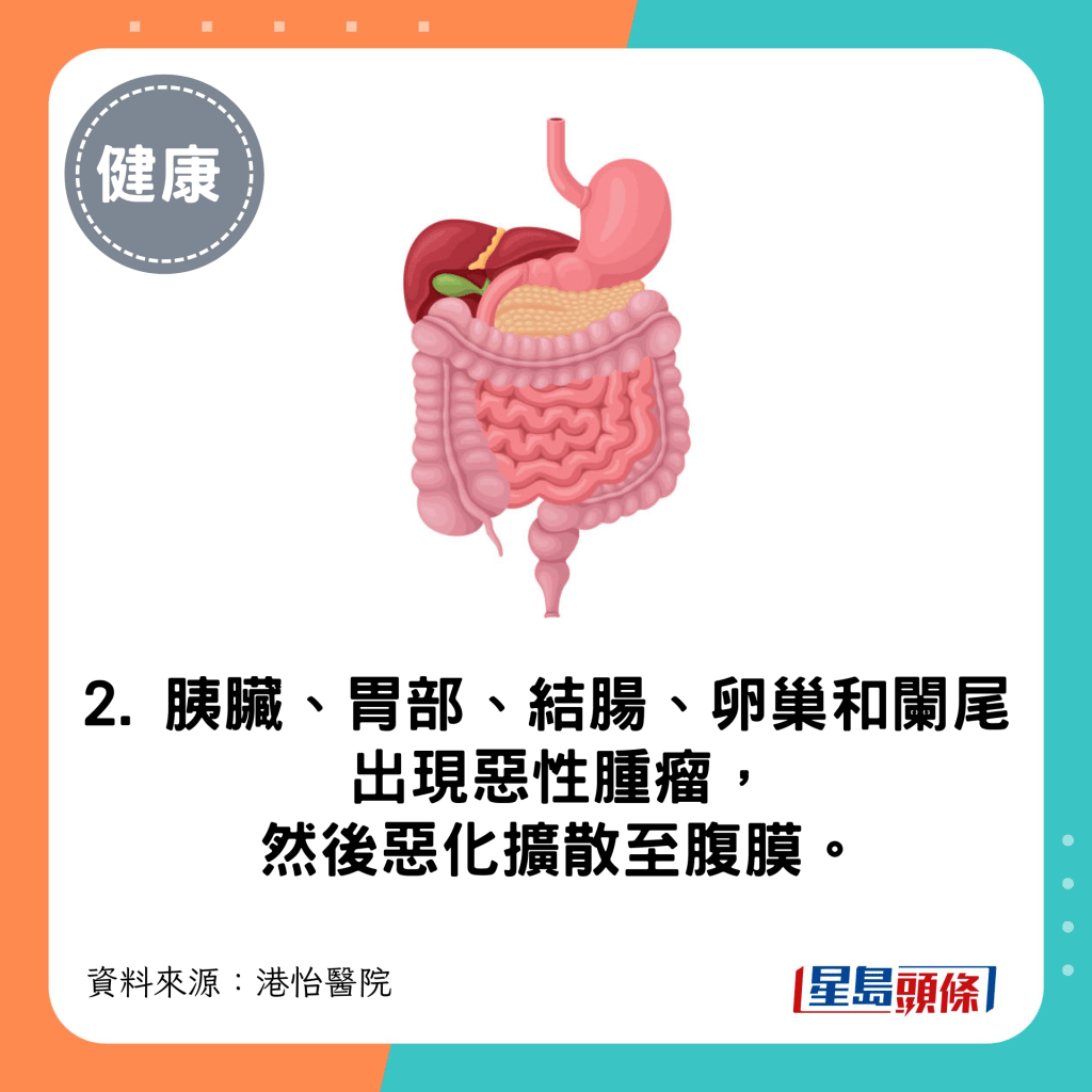 胰臟、胃部、結腸、卵巢和闌尾出現惡性腫瘤，然後惡化擴散至腹膜
