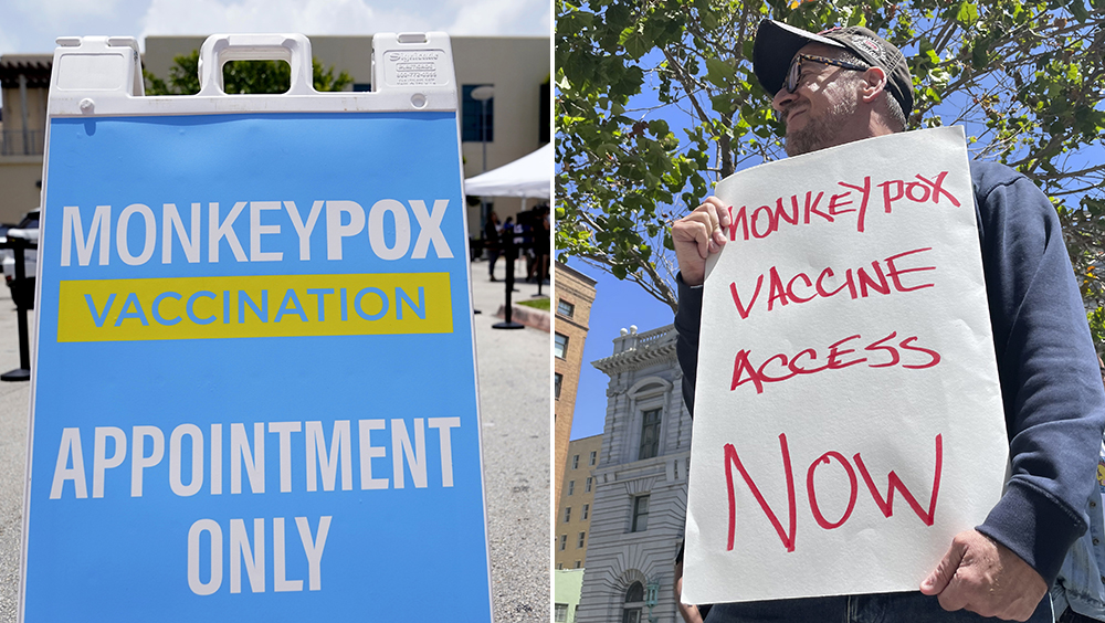 美国猴痘确诊病例超过1万宗，政府应对不力遭批评。AP