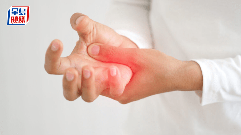 关节炎严重影响生活。