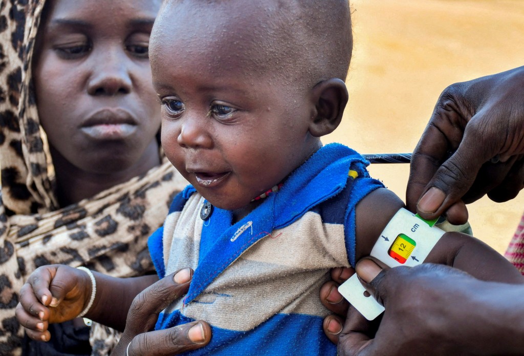 聯合國人員為一名逃離蘇丹的兒童檢查是否營養不良。 路透社