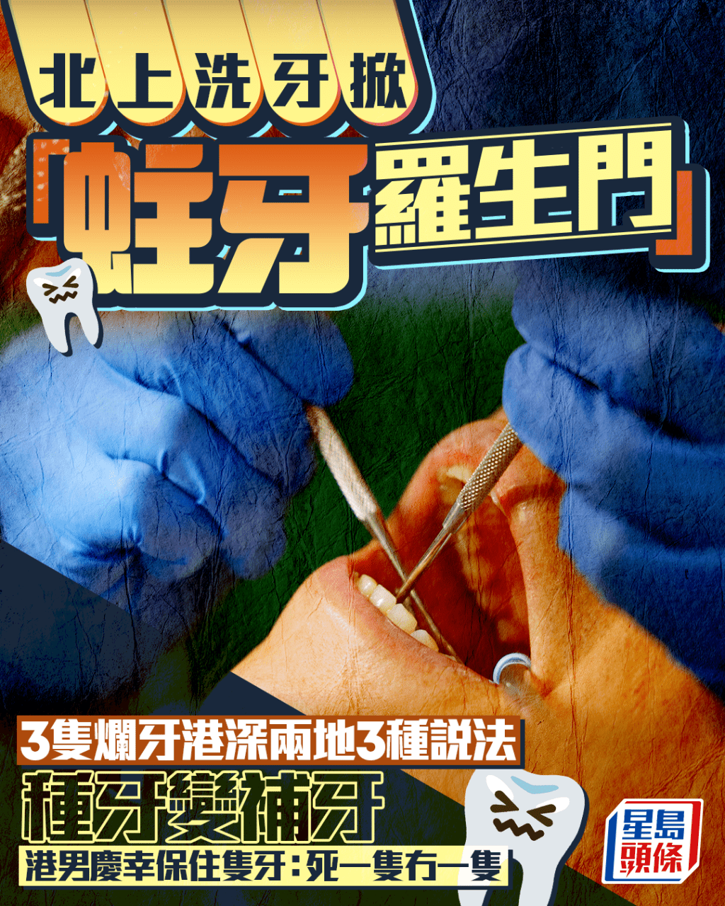 北上洗牙掀「蛀牙羅生門」 3隻蛀牙港深兩地3種說法 種牙變補牙 港男慶幸保住隻牙｜Juicy叮