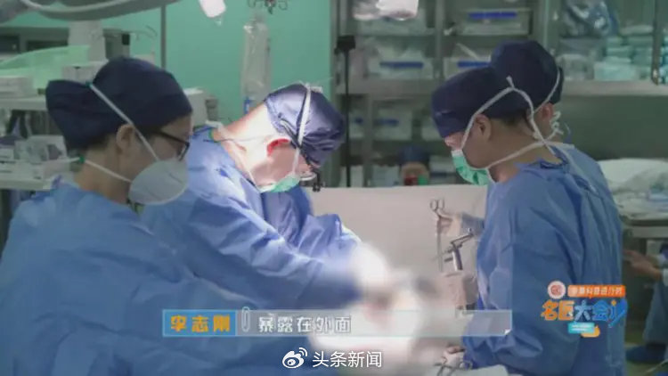 醫生為楊先生進行結腸代食道手術。