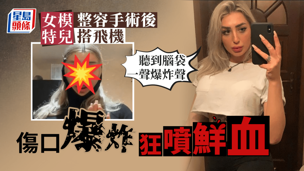 女網紅眼部整形後搭飛機，傷口爆炸如遭「爆頭」。