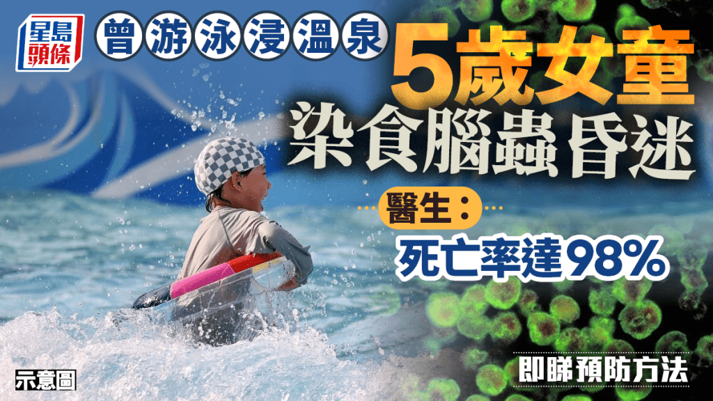 食腦蟲｜5歲女童溫泉玩水感染昏迷不醒  醫生：死亡率達98%