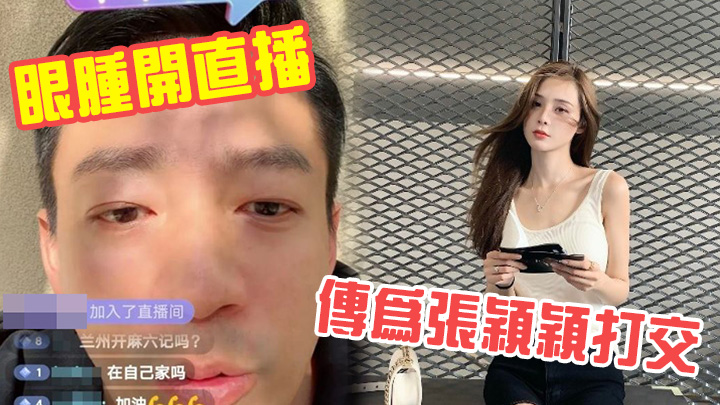 汪小菲眼腫腫開直播，叫大家唔好信網上傳言。