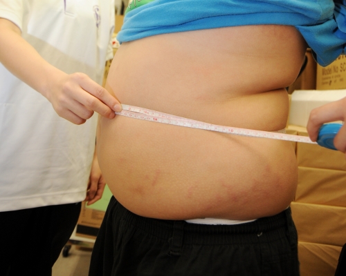 肥胖是罹患肝癌元凶之一。示意圖片