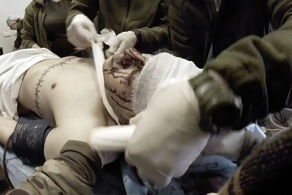 女軍醫拍下的片紀錄了為烏克蘭馬里烏波爾一名受傷軍人頭部包紮。AP