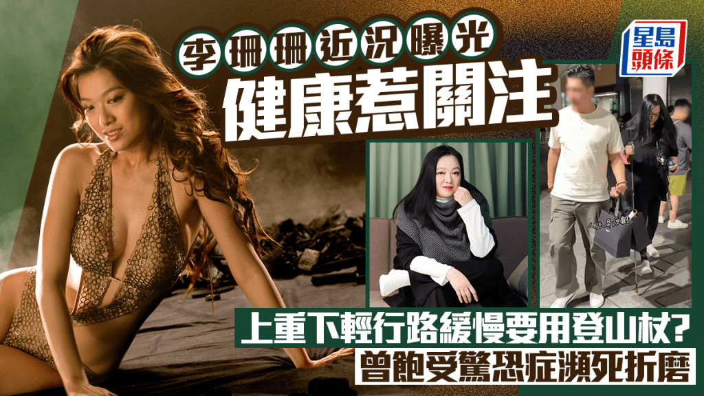 李珊珊近況曝光健康惹關注  上重下輕行路緩慢要用登山杖？  曾飽受驚恐症瀕死折磨