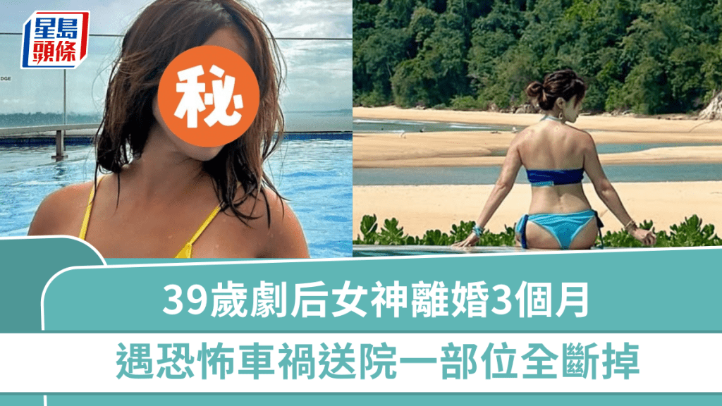 39歲劇后女神離婚3個月  遇恐怖車禍被拖行數公尺  送院一部位全部斷掉