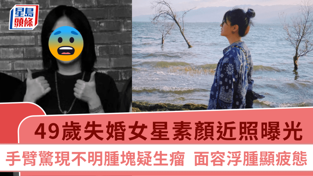 49歲失婚女星素顏近照曝光 手臂驚現不明腫塊疑生瘤 面容浮腫顯疲態
