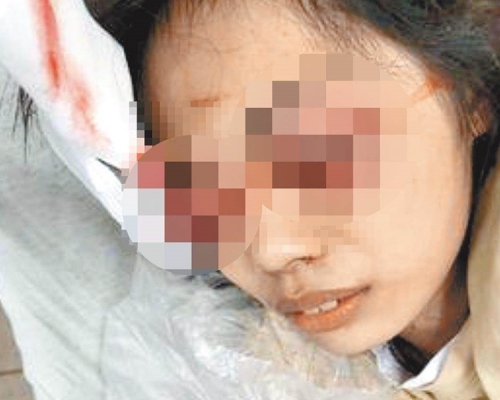 潘女已完成兩次手術。網圖