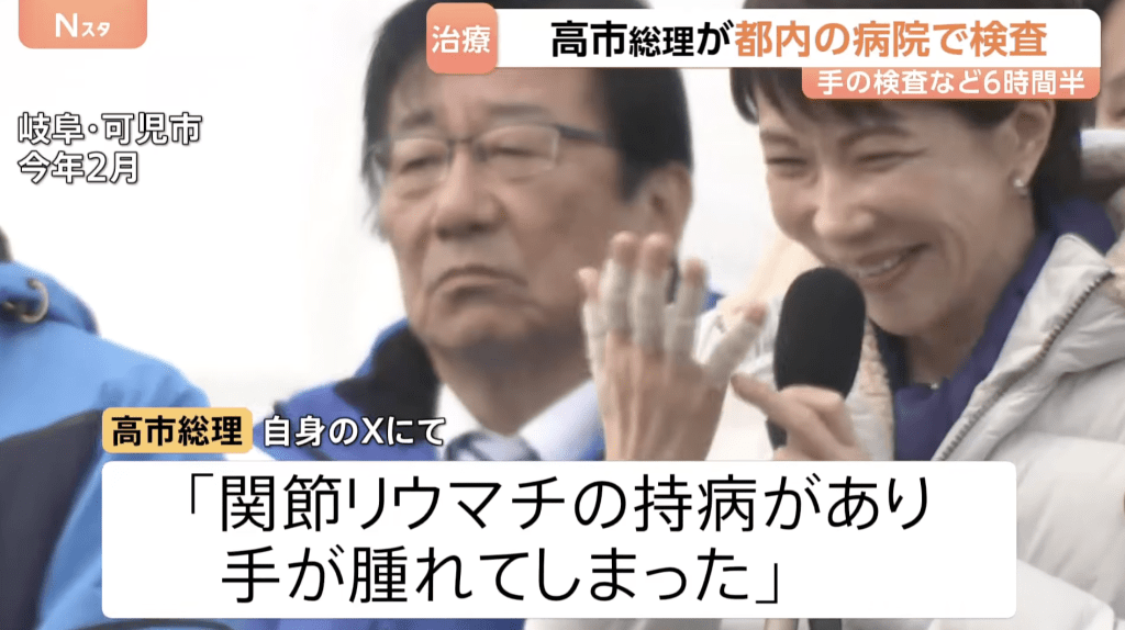 高市的手部問題源於今年初眾議院大選拉票期間。TBS NEWS 高市的手部問題源於今年初眾議院大選拉票期間。TBS NEWS