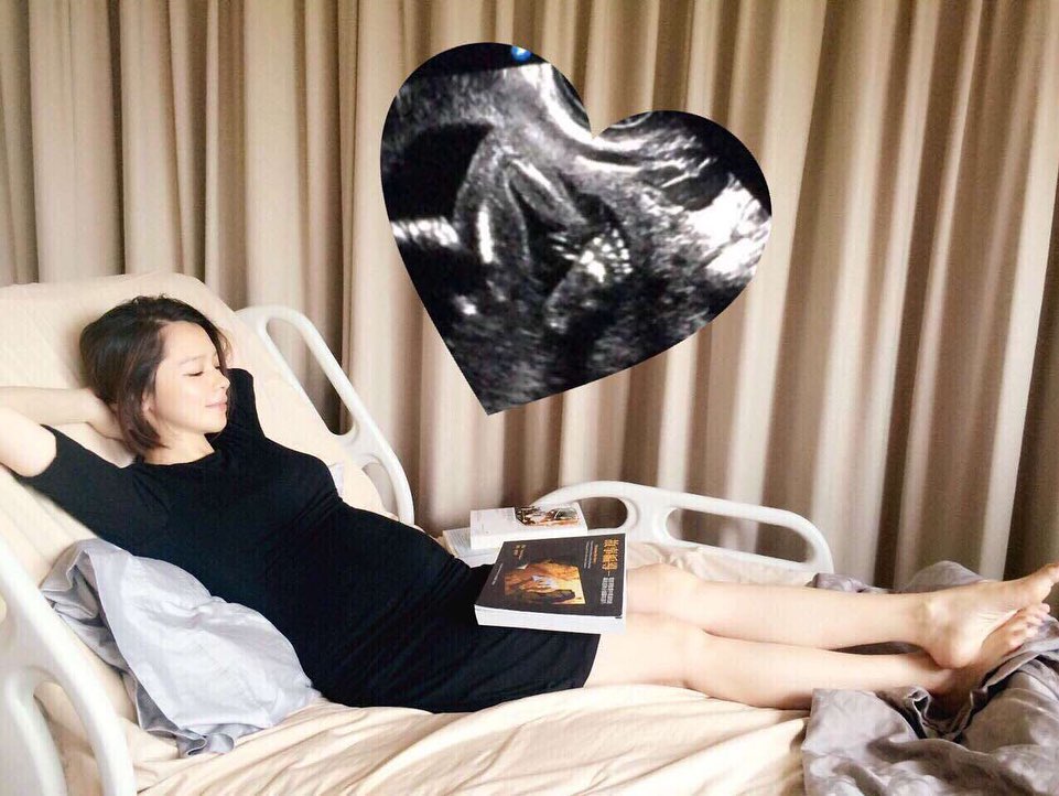 為保住胎兒,足足5個月沒有下床。