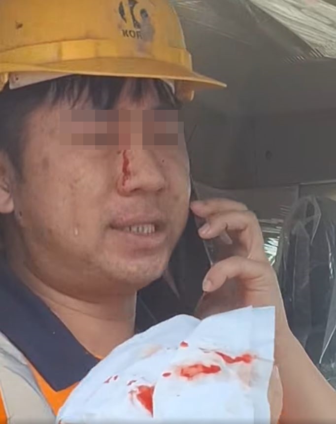 田螺車司機面部流血更「標眼水」。fb馬路的事討論區影片截圖