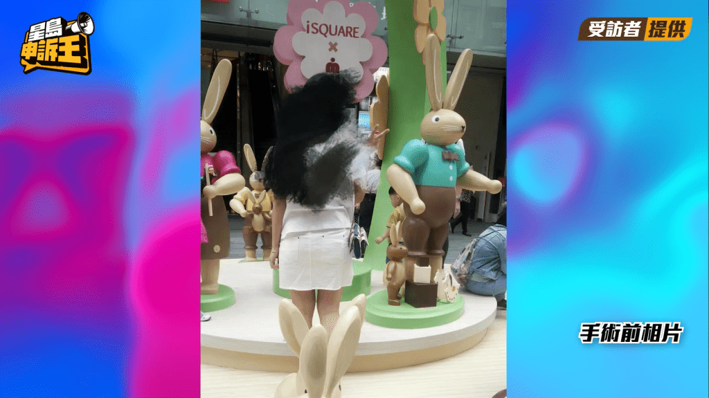 朱小姐手術前常會穿着短褲。（來源：受訪者提供）