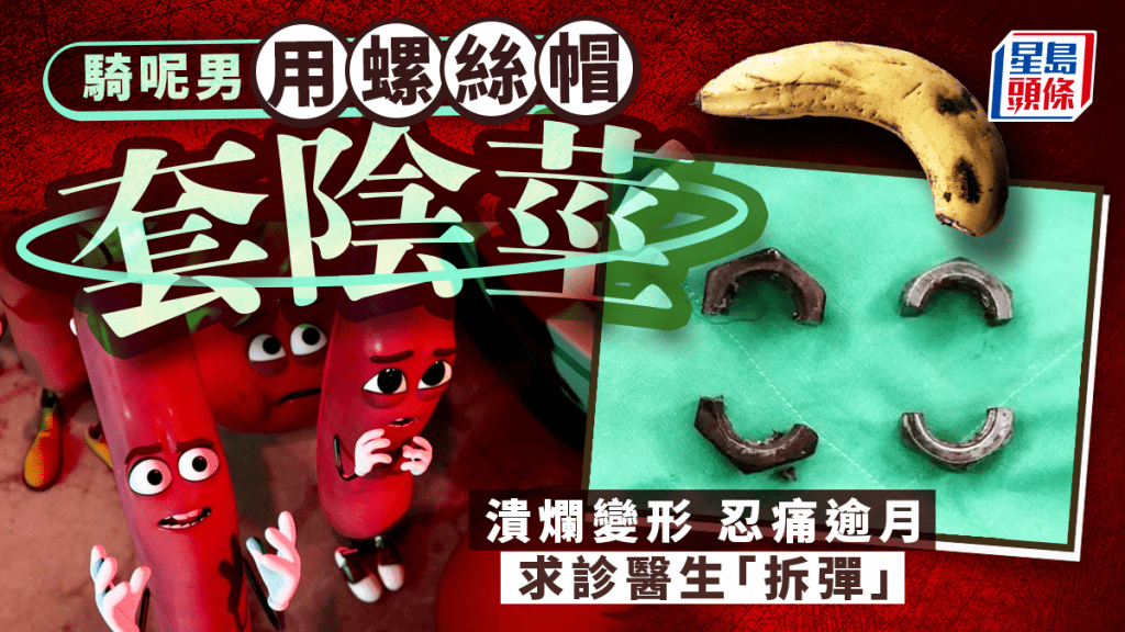 螺絲帽套陰莖︱越南騎呢男忍痛逾月求診  醫生驚見潰爛變形急「拆彈」