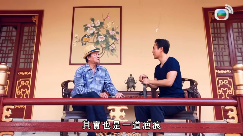 對於當年的嚴苛做法，狄龍坦言此事在他心中，「其實也是一道疤痕」。