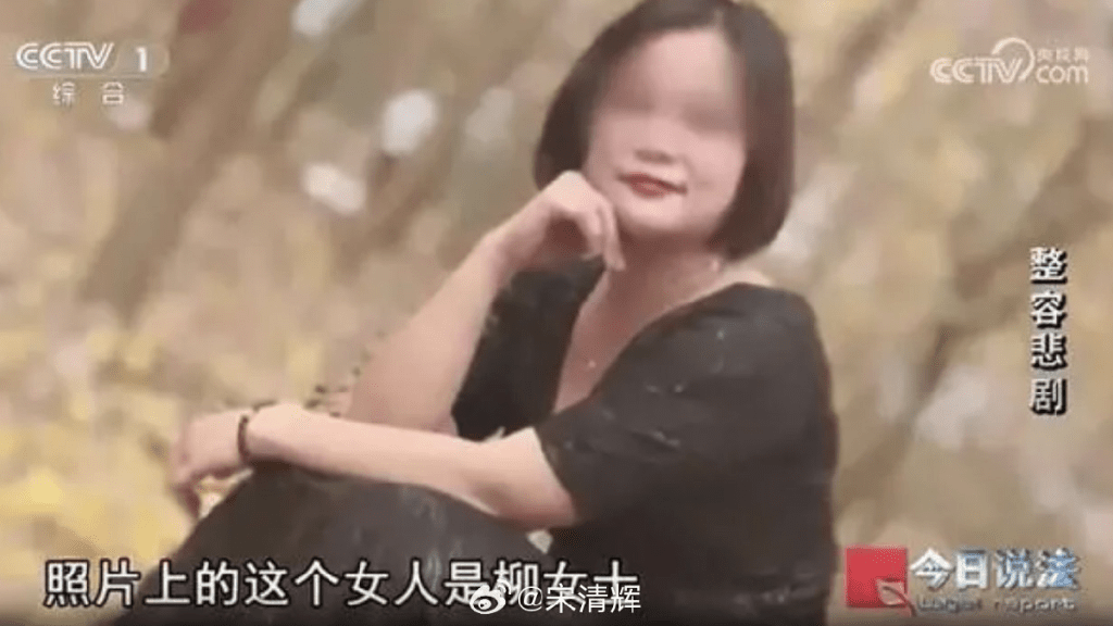 柳女士瞞丈夫，一天內做6次整容手術猝死。