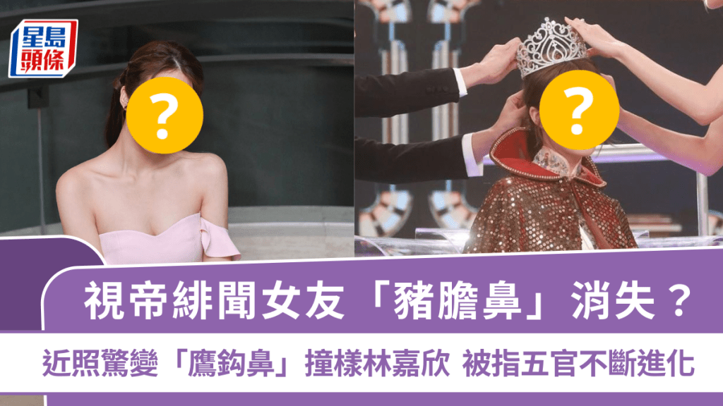 視帝緋聞女友「豬膽鼻」消失？近照驚變「鷹鈎鼻」撞樣林嘉欣  入行3年被指五官不斷進化