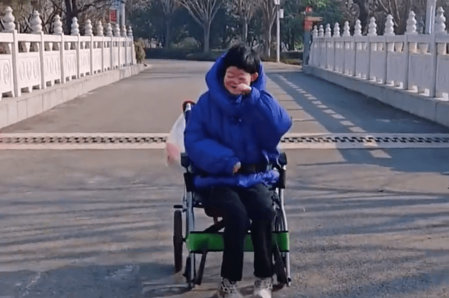 15年間,高尚好共接受5次分指手術。 15年間,高尚好共接受5次分指手術。