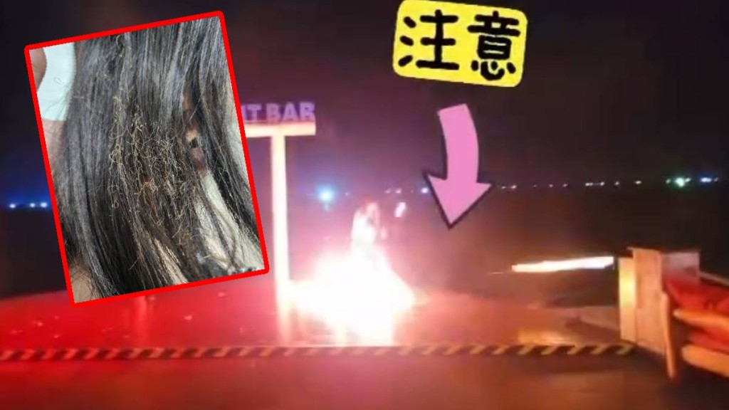有港人到越南富國島看酒店的火舞表演，被火球擊中受傷燒焦頭髮。Threads@n.y_travel