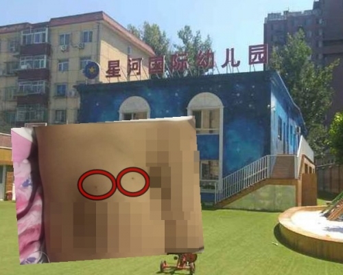北京一間幼稚園疑發生虐童事件。網圖