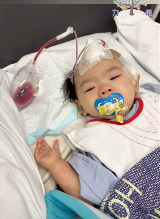 小雪兒周一順利進行重置頭骨手術。香港關懷力量FB圖片
