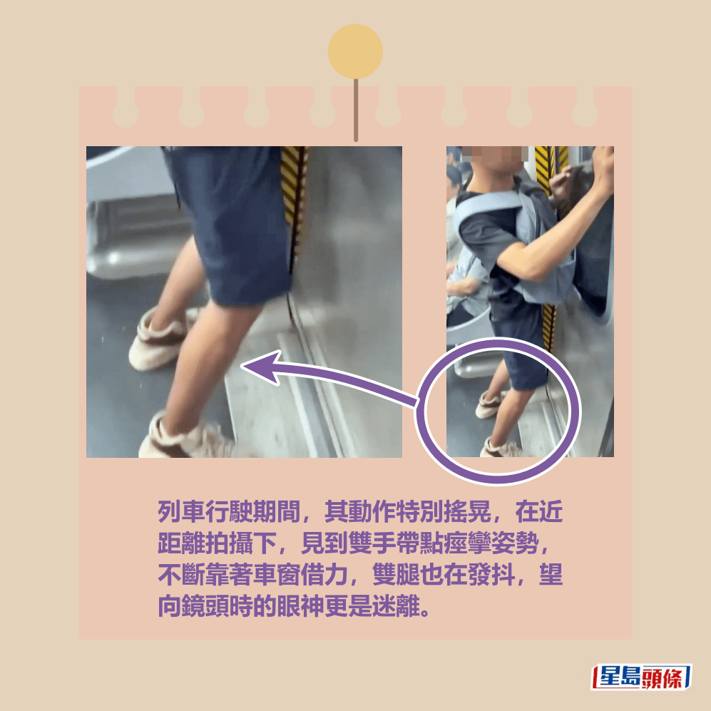 列車行駛期間,其動作特別搖晃,在近 距離拍攝下,見到雙手帶點痙攣姿勢, 不斷靠著車窗借力,雙腿也在發抖,望 向鏡頭時的眼神更是迷離。fb「香港突發事故報料區及討論區」截圖 列車行駛期間,其動作特別搖晃,在近 距離拍攝下,見到雙手帶點痙攣姿勢, 不斷靠著車窗借力,雙腿也在發抖,望 向鏡頭時的眼神更是迷離。fb「香港突發事故報料區及討論區」截圖