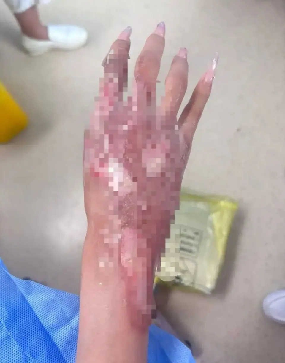 女博主发布伤情照片。 小红书