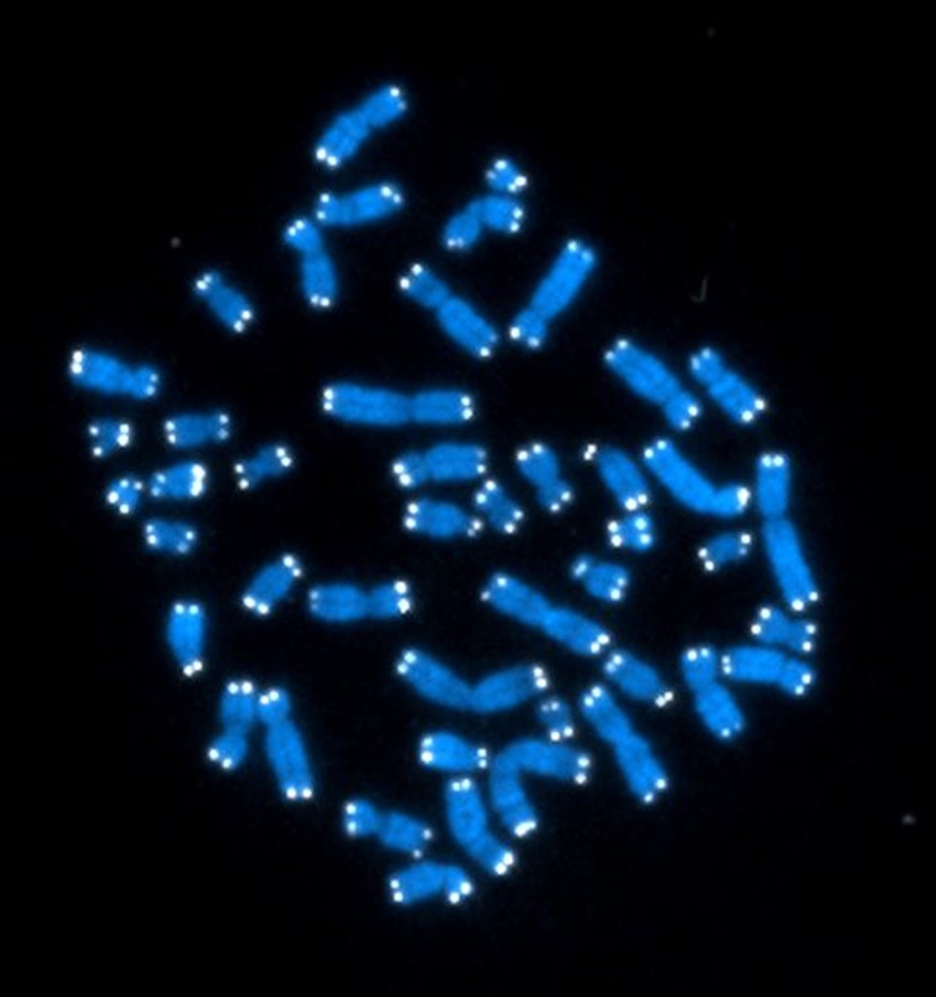 图像显示人类的46条染色体。 美联社