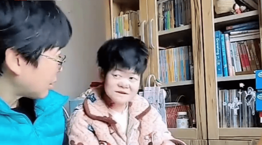 15年間,高尚好共接受5次分指手術。 15年間,高尚好共接受5次分指手術。