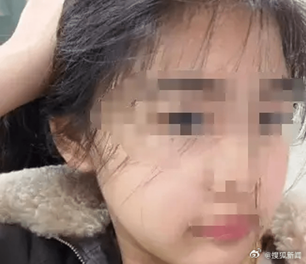 女生被教官將頭髮綁在柱子上,又在烈日下暴曬。 女生被教官將頭髮綁在柱子上,又在烈日下暴曬。