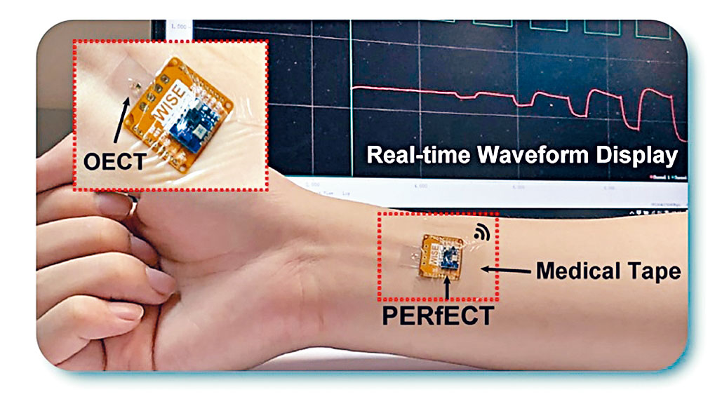 港大研發名為PERfECT的微型可穿戴生物電子傳感器，是全球同類技術中最細小的系統。