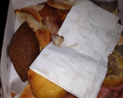 人類手指現肉餅。網圖