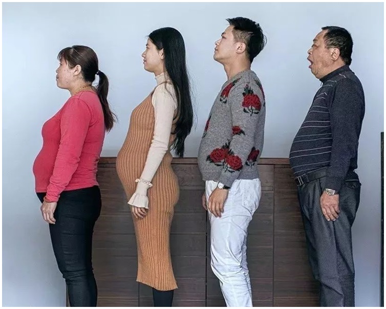 減肥前一家人都有啤酒肚。